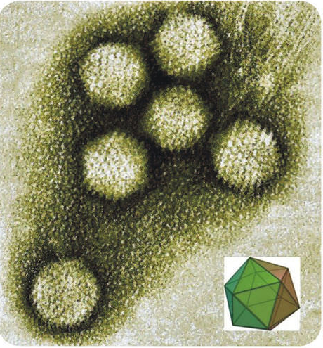 Diagrama de un citomegalovirus
